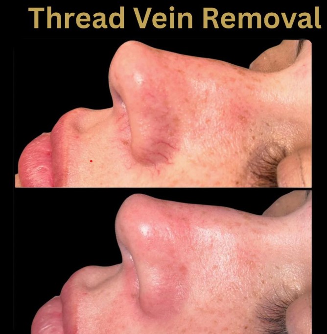 Skin Hautê Treatment